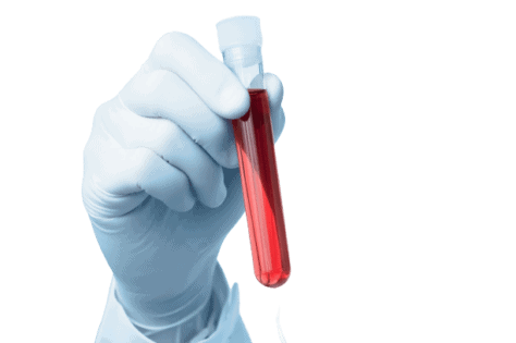 Krvne preiskave za določitev spolnih hormonov